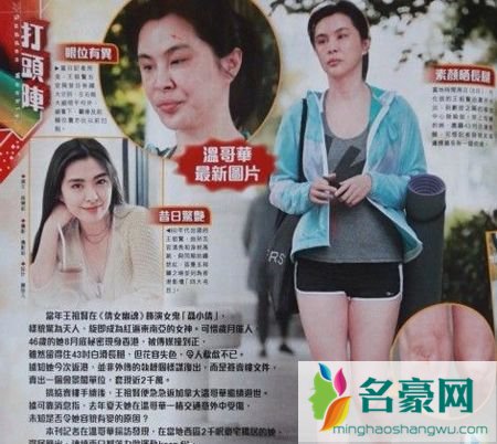 王祖贤车祸伤疤图 王祖贤温哥华车祸照片及资料