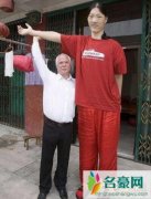 女巨人姚德芬身高2.36米（终身病痛折磨-照片/视频）