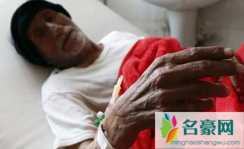 得了霍乱的人的图片2