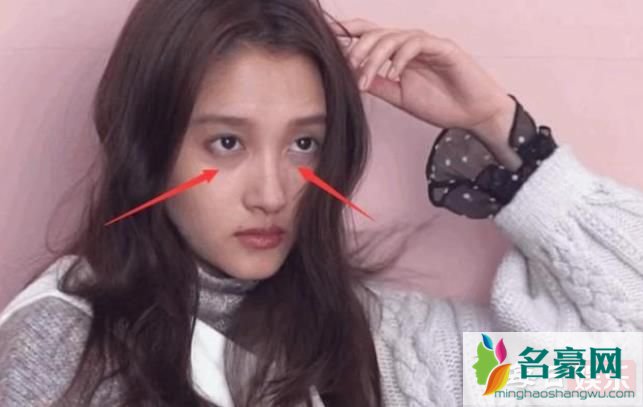 关晓彤回应黑眼圈说了什么 关晓彤最近遇到了什么事?