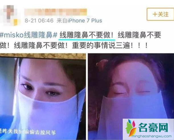 杨紫现身整形医院是怎么回事 杨紫她到底怎么了?