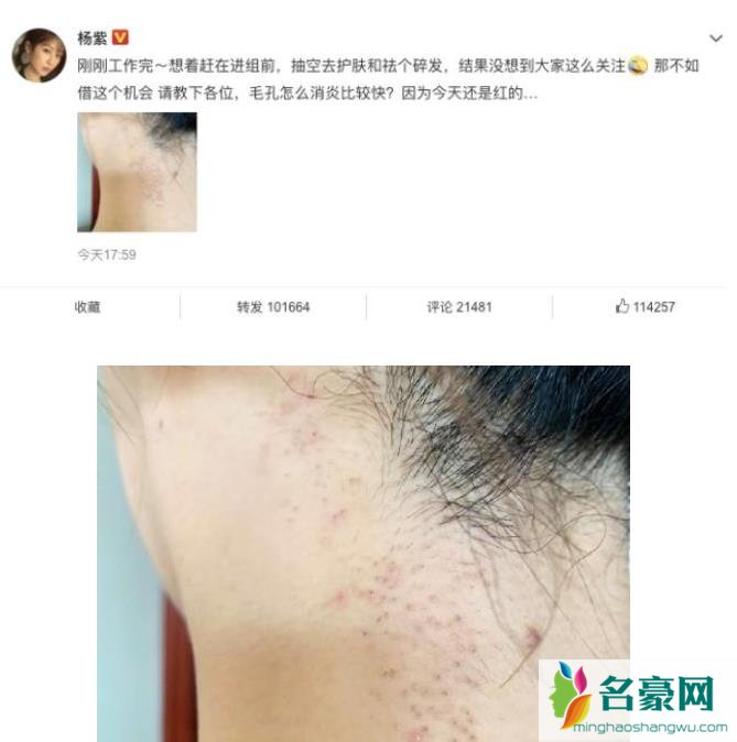 杨紫现身整形医院是怎么回事 杨紫她到底怎么了?