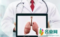 30岁查出肺结节吓人吗 肺结节最怕三种运动