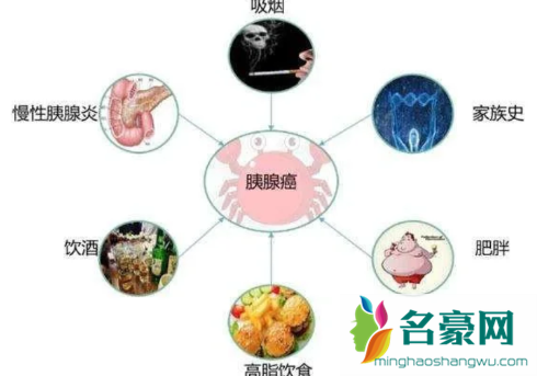 很多胰腺癌都是误诊吗2