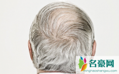 白发用什么染发最安全 五十岁白头发不染剪什么发